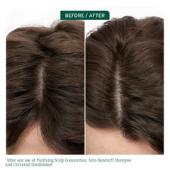 Biolage Scalp Sync Purifying Concentrate - For All Scalp Types, Exfoliating & Clarifying Treatment, Removes Buildup, Refreshing & Reinvigorating, Fermented Tea Blend & Glycolic Acid