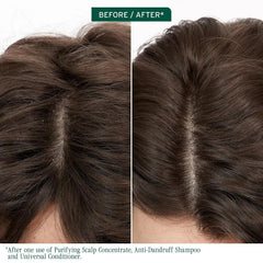 Biolage Scalp Sync Anti-Dandruff Shampoo - Controls Itchy Scalp, Deeply Cleanses Hair, Moisturizing Shampoo For Dandruff Relief, For Scalp and Hair Health, Vegan & Cruelty-Free