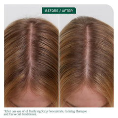 Biolage Scalp Sync Universal Conditioner - Nourishing & Hydrating for All Scalp Types, Lightweight Moisturizing & Conditioning, Fermented Tea Blend & Glycolic Acid, Vegan & Paraben-Free